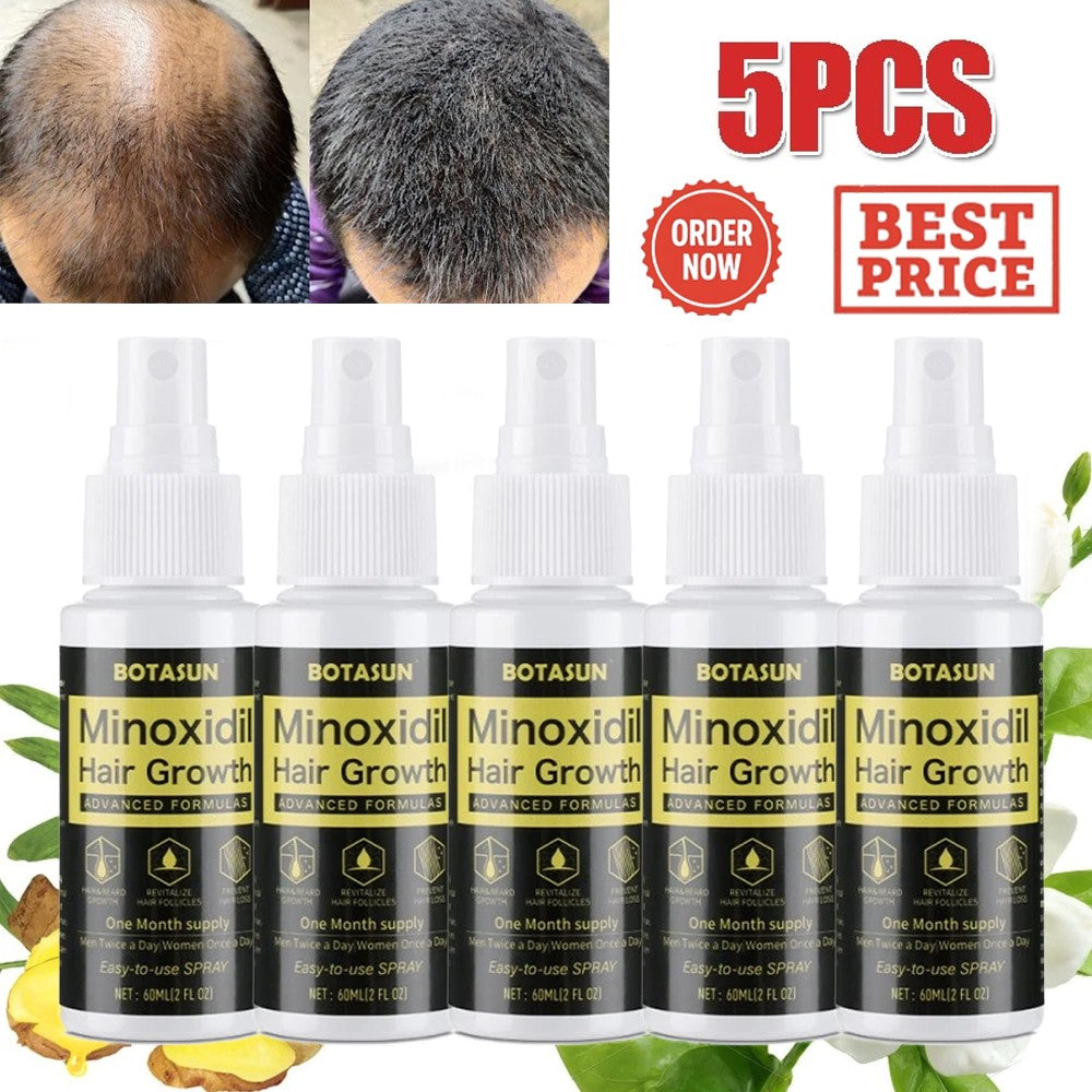 Minoxidil 5% Topical Solution for Men Hair Regrowth, Reactivates