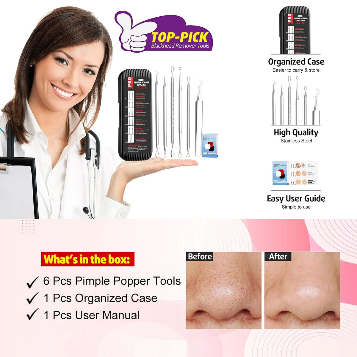 Blackhead Remover Tools 6-Pack - Gentle Stainless Steel Acne Extractors