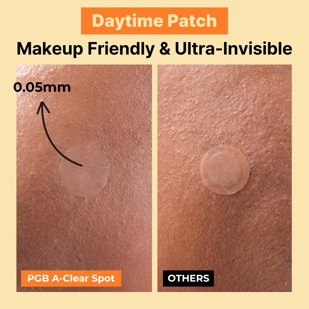 Acne Pimple Patches Set - Invisible, Waterproof, 3 Sizes for Spot Treatment