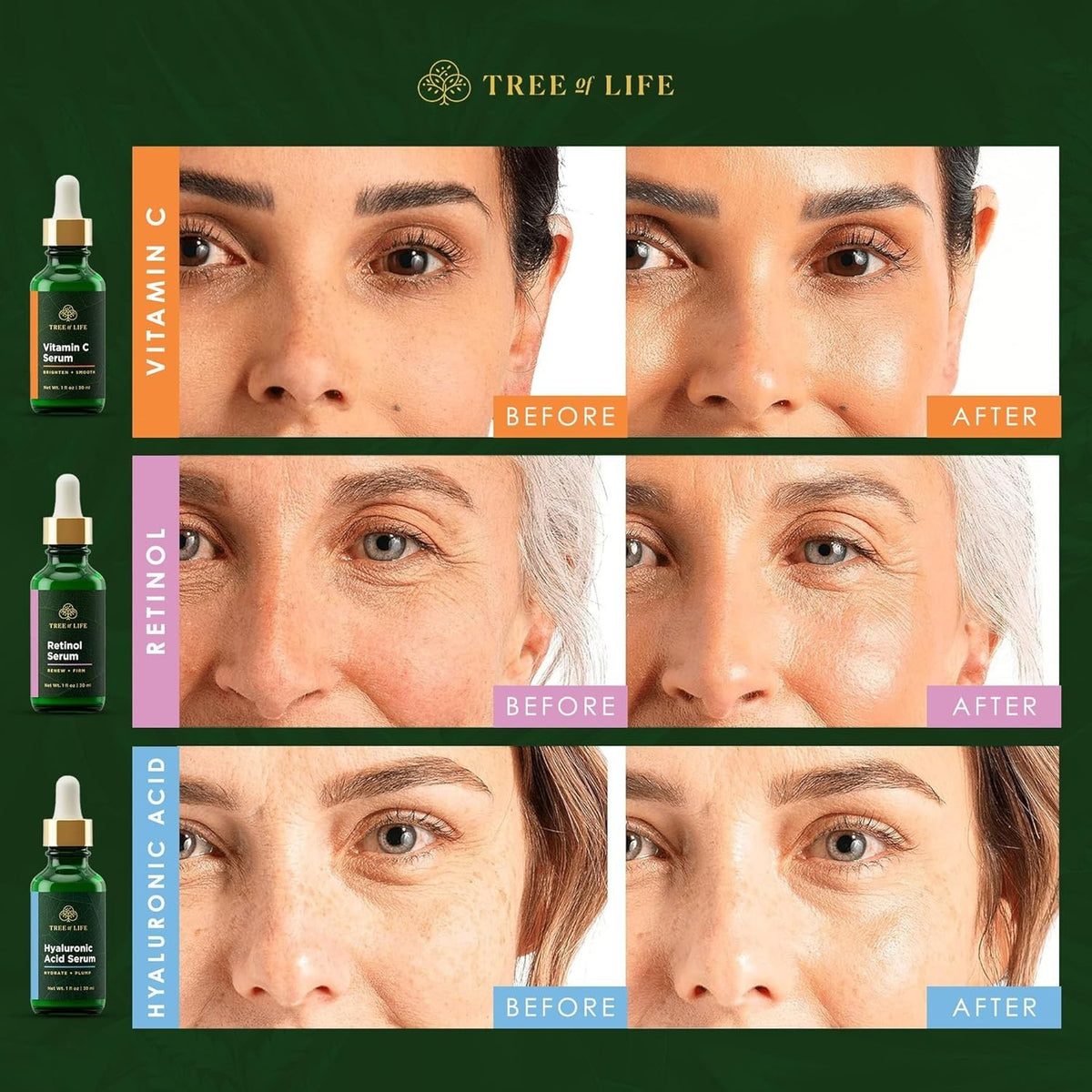 Brightening & Firming Skin Care Serum Trio - Hydrating Anti-Aging Set
