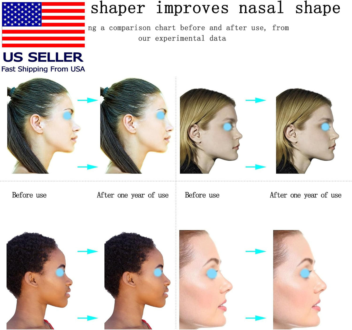 Nose Shaper Lifter Clip for Wide Noses - Reshape & Straighten