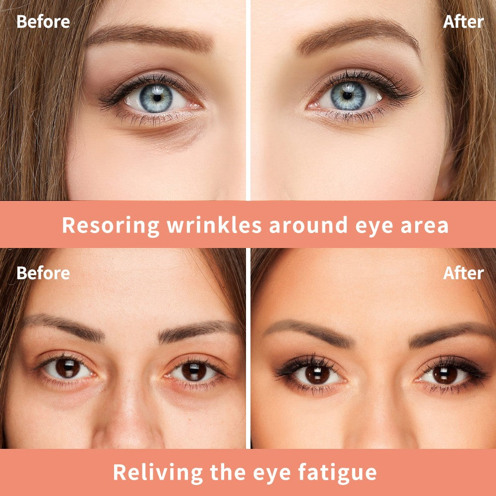 Reduction Eye Cream for Dark Circles & Wrinkles - 0.7 fl oz