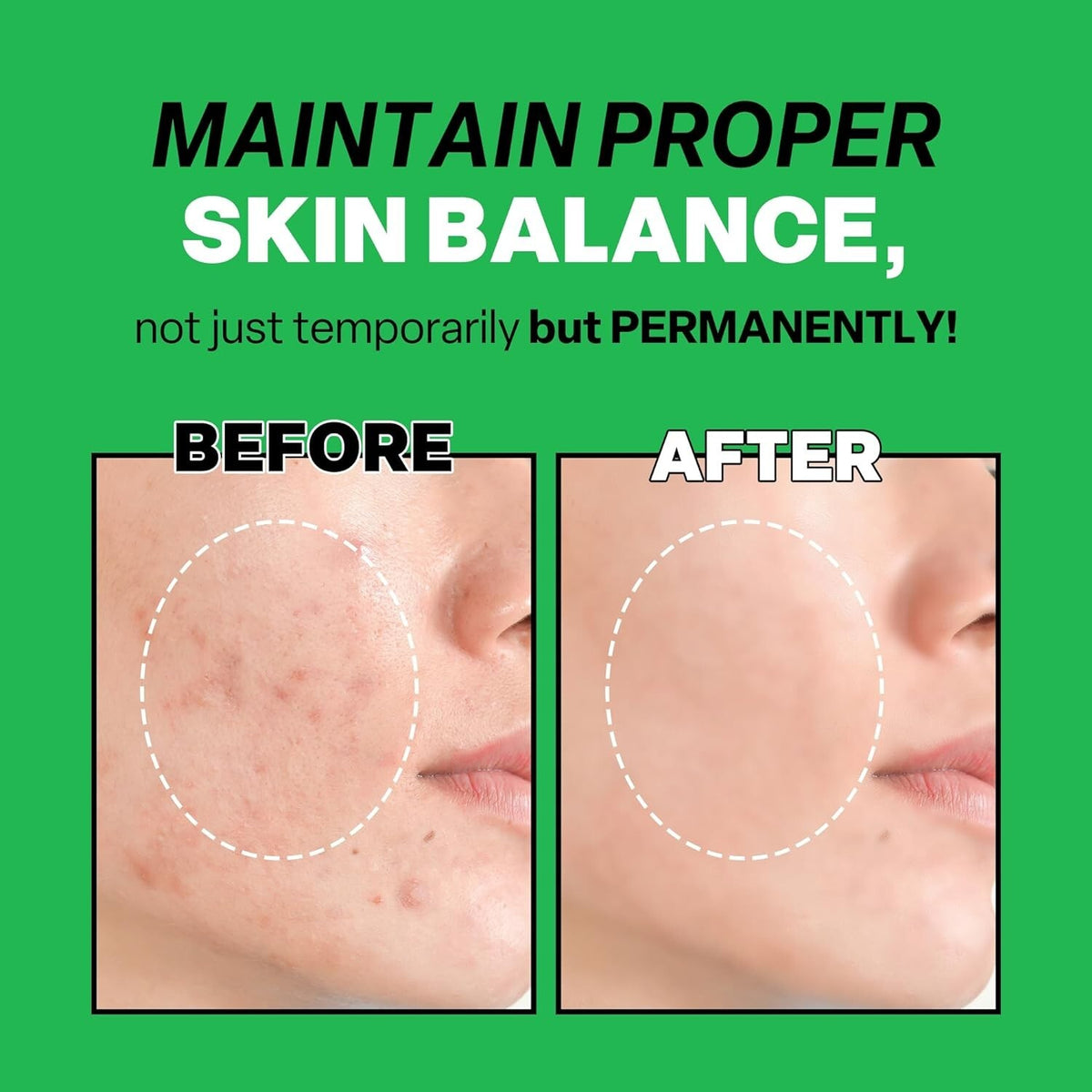 Troubless Mild Clear Toner Essence with Tea Tree & 4-Terpineol for Sensitive Skin - 6.76 fl oz