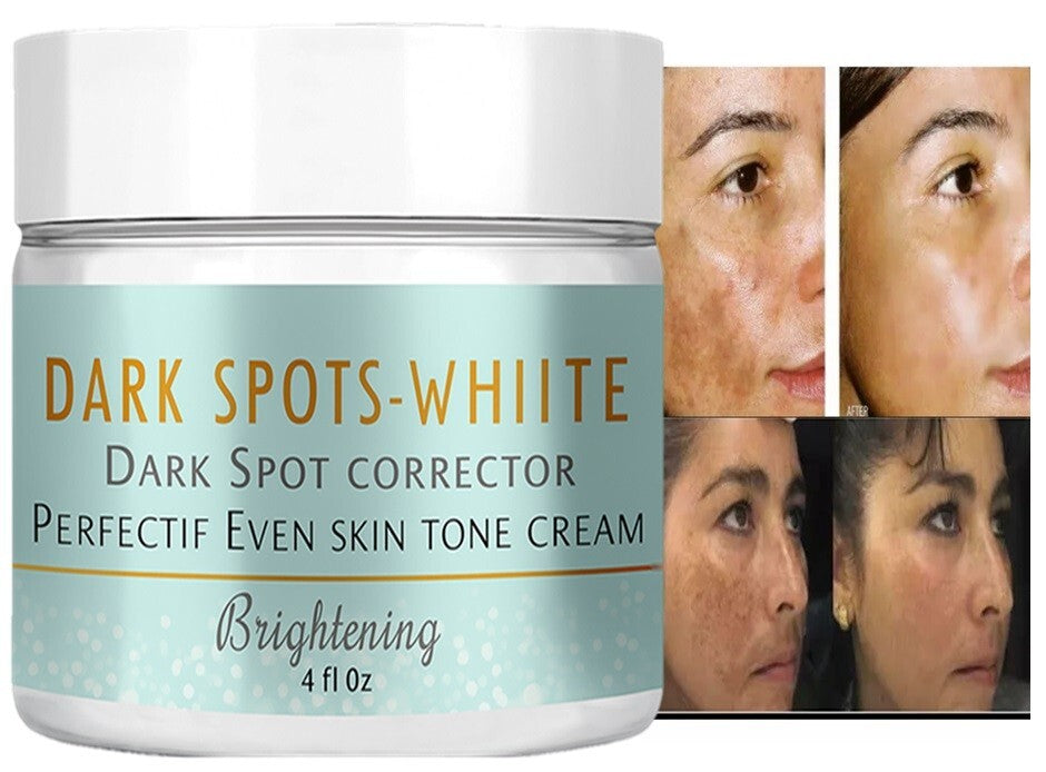 Dark Skin Brightening Face Cream for Acne & Freckles - Supports Light Fade