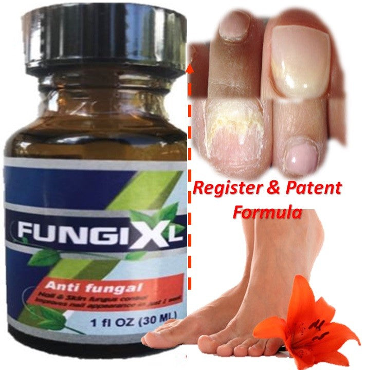 Nail Fungus Support Solution for Toe and Finger Nails - Maximum Strength 100%