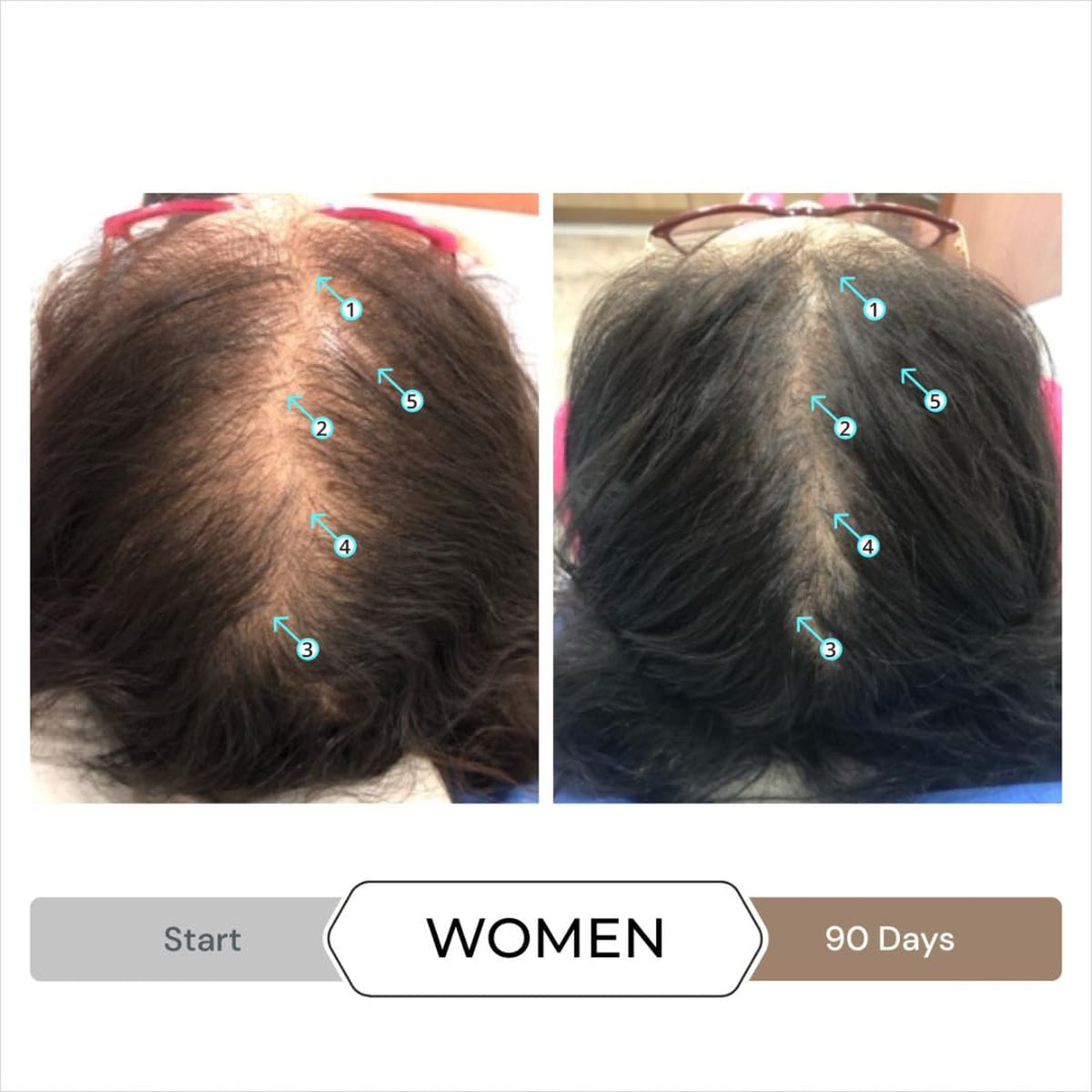 Men's Hair Density Serum Spectral Booster Leave-In Thickening