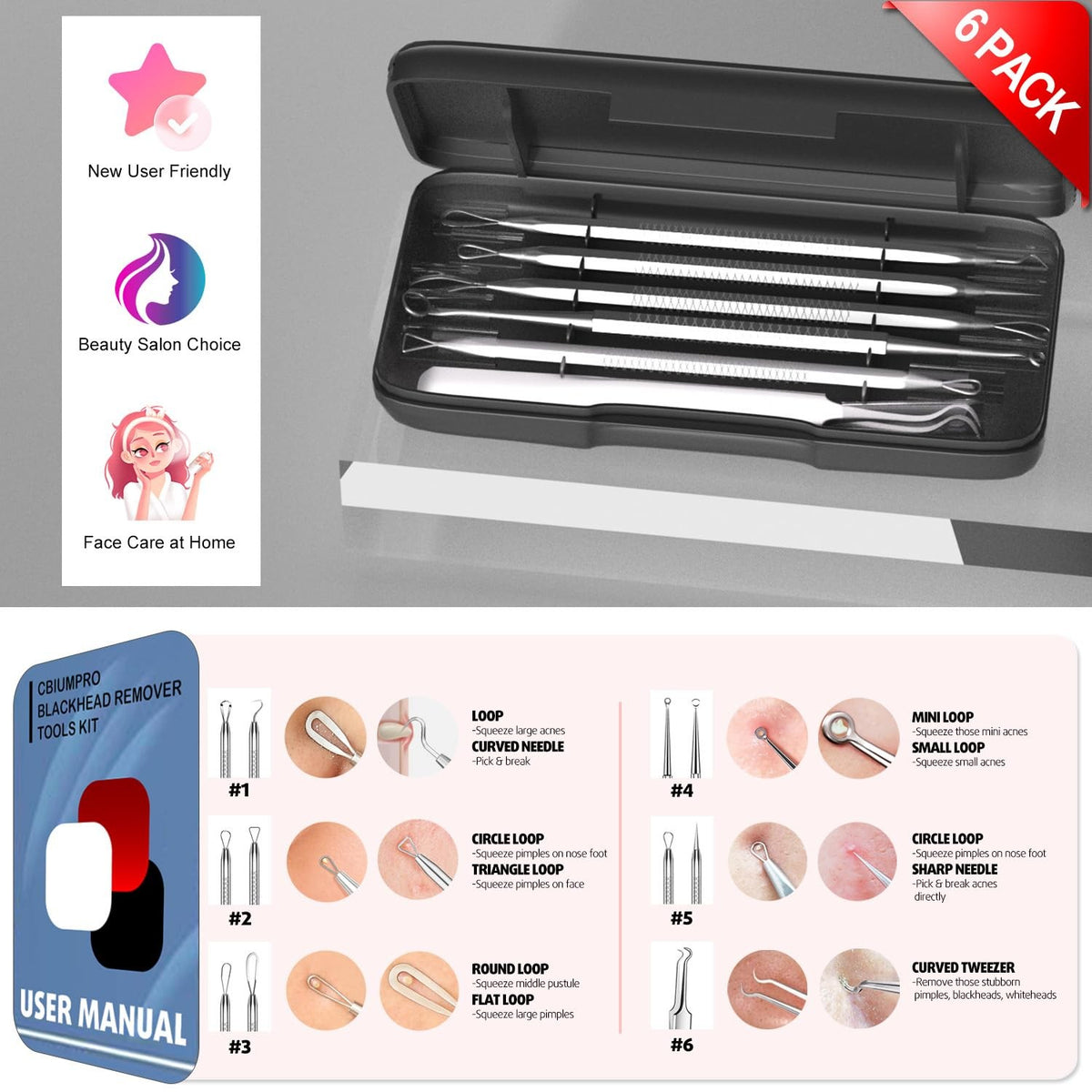 Blackhead Remover Tools 6-Pack - Gentle Stainless Steel Acne Extractors