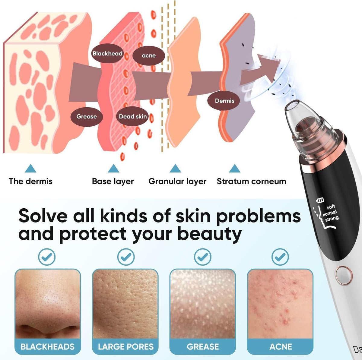 Blackhead Remover Vacuum Pore Cleaner with 3 Suction Levels & 5 Tips