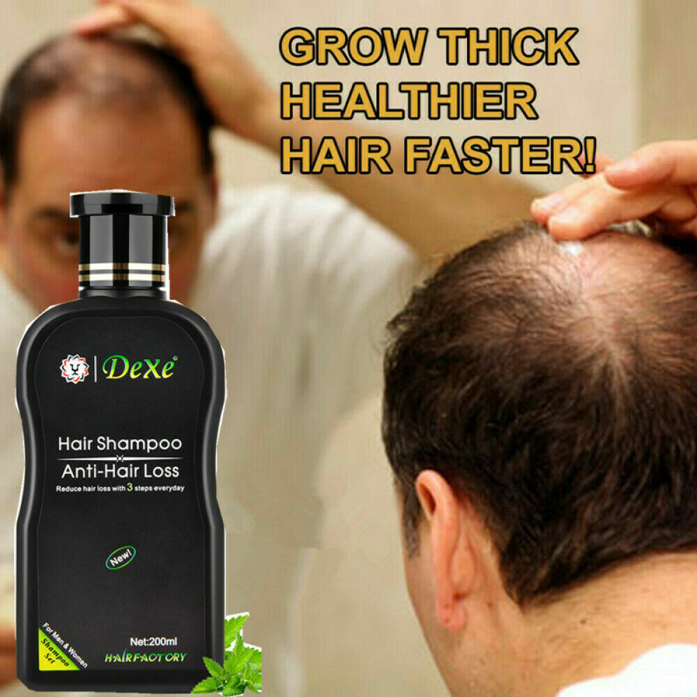 Ginger Hair Loss Shampoo with Herbal Extract – 200ml