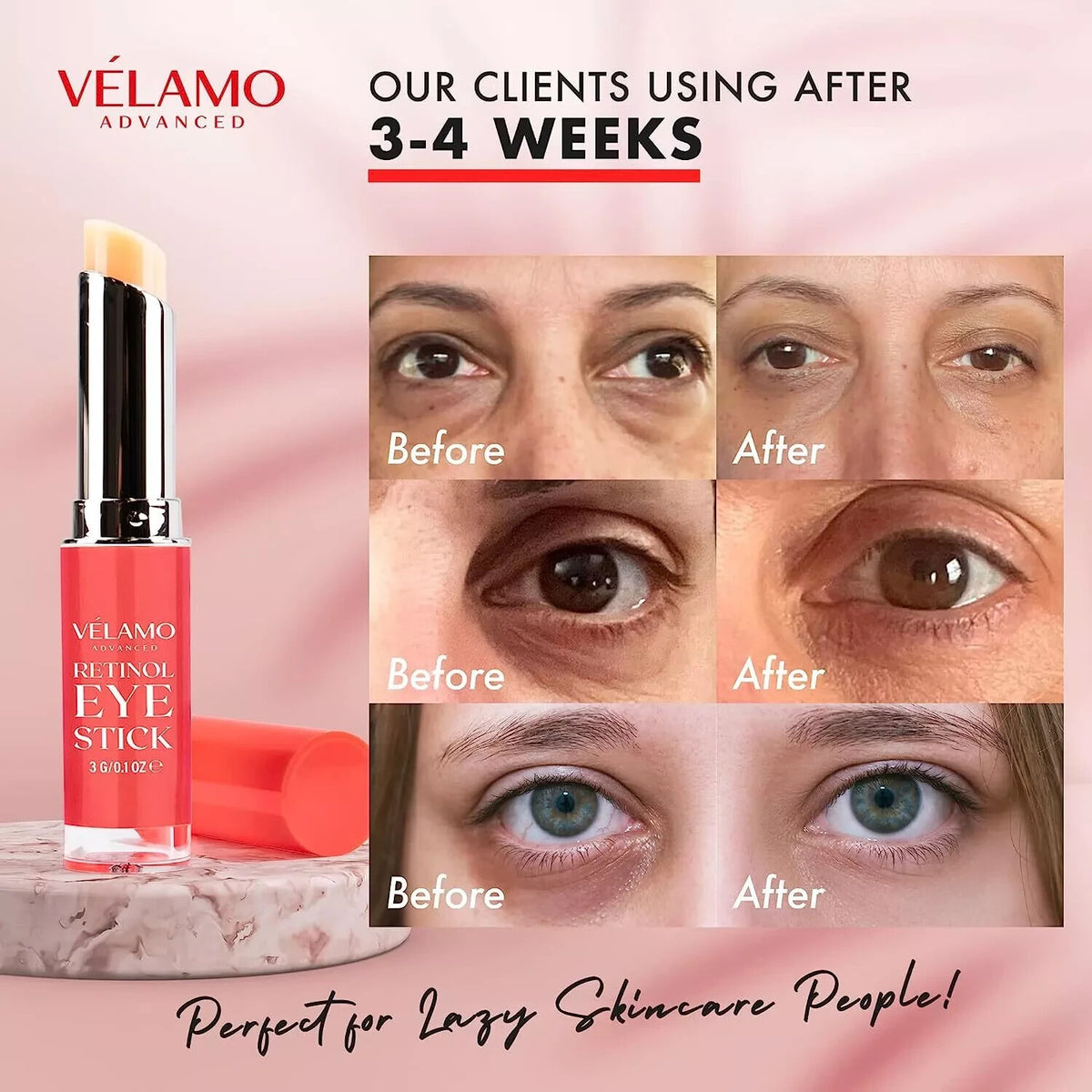 Retinol Eye Stick for Dark Circles & Puffiness - 4 Pack