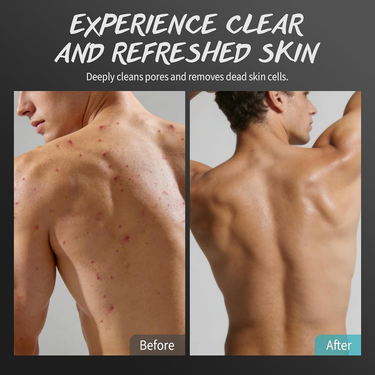 Men's Exfoliating Body Scrub with Tea Tree Oil for Back Chest Shoulders