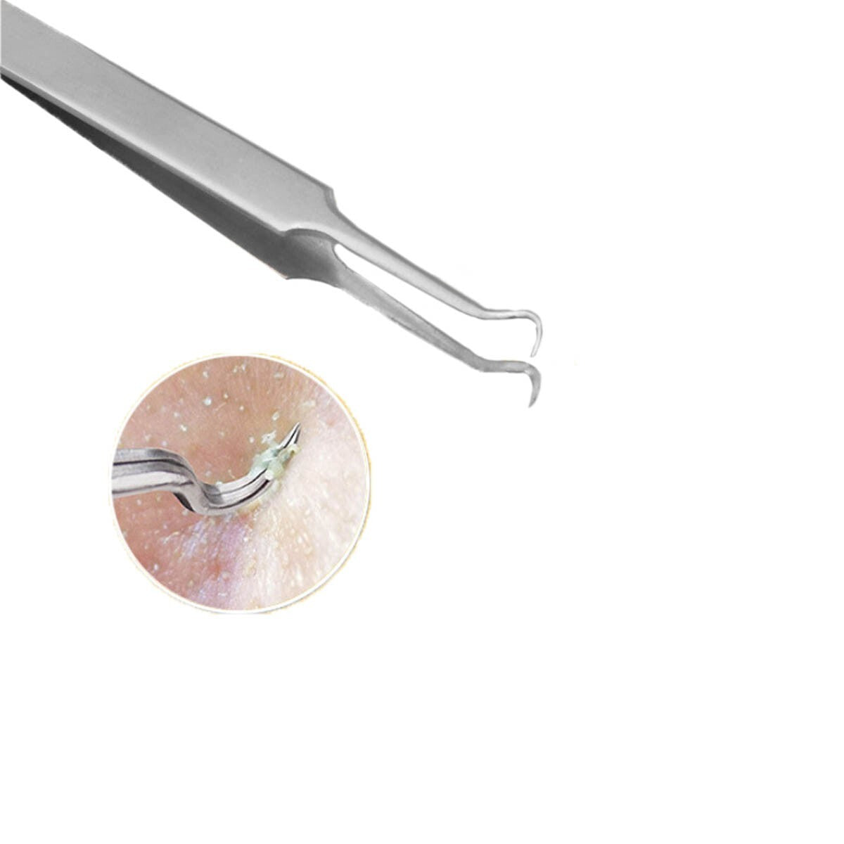 9-Piece Blackhead Acne Extractor Kit - Professional Pimple Popping Tools