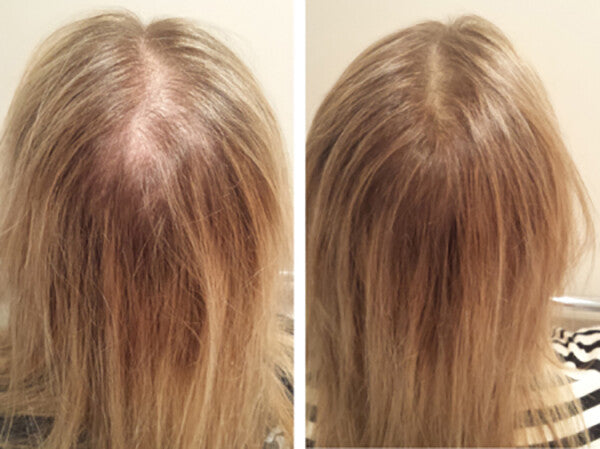 Hair Loss Conditioner - 16 Organic Oils for Men & Women