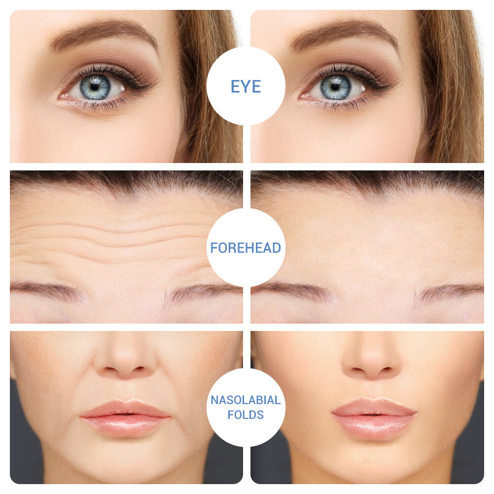 Hyaluronic Acid Microneedle Eye Patches Anti-Aging Dark Circles Fine Lines Moisturizer