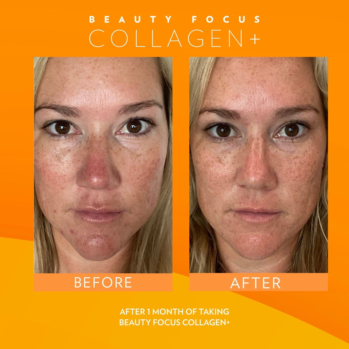 Liquid Collagen Drink for Skin Radiance and Anti-Aging - Peach Flavor, 30 Days Supply