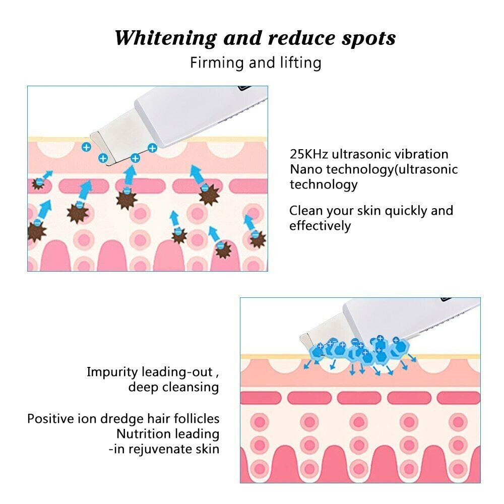 Ultrasonic Pore Cleaner for Blackhead Removal Facial Skin Scrubber