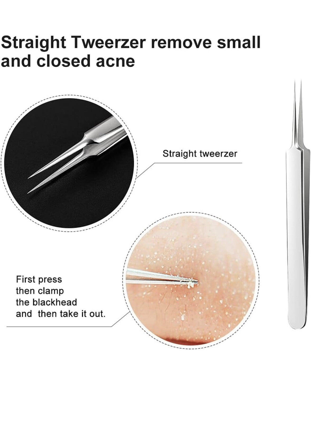 3-Piece Blackhead Remover Kit - Pimple & Acne Extraction Tools Set