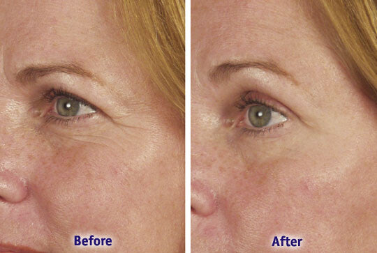 Anti-Aging Peptide Serum with Argireline Hyaluronic Acid Collagen