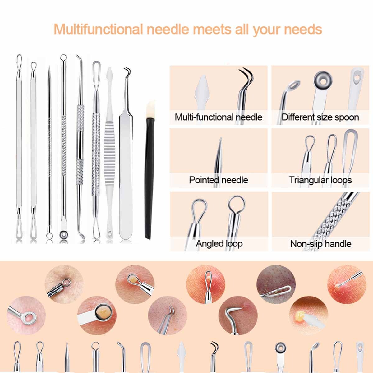 Blackhead Extractor Tool Kit - 15 Pimple Comedone Acne Spot Removers