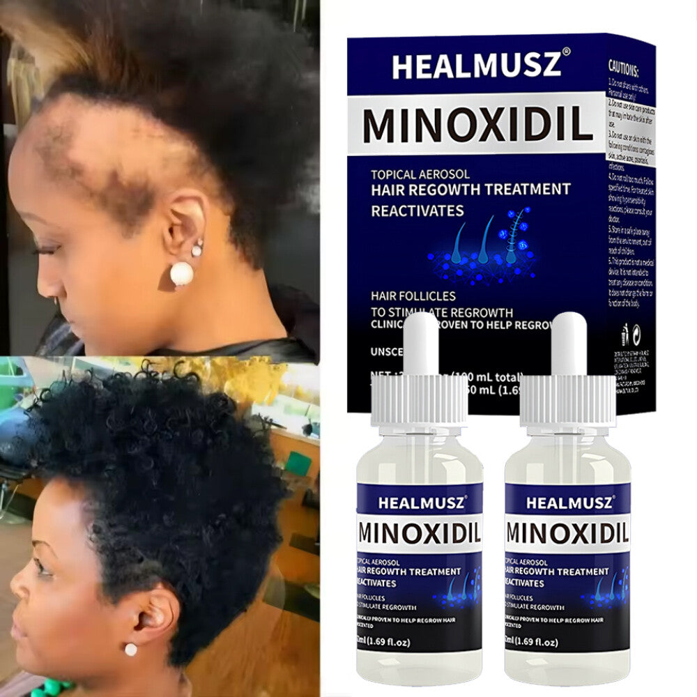 5% Minoxidil Hair Regrowth Treatment - 50ml x 2