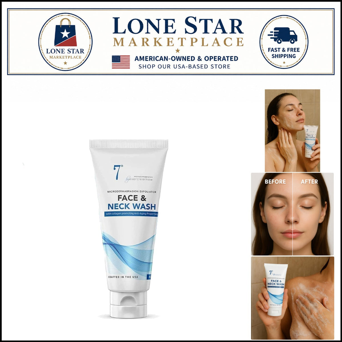 Aloe Vera Microdermabrasion Cream - Exfoliating Scrub for Acne & KP,
