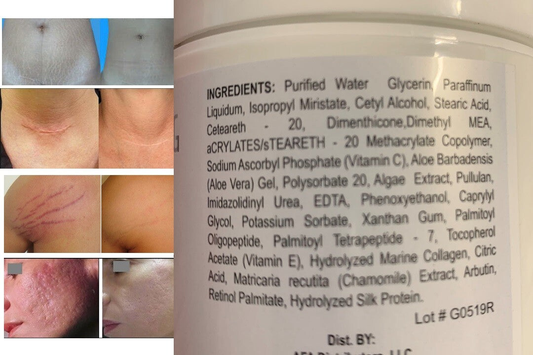 Facial Moisturizer with Aloe Vitamin C Marine Collagen - Arbutrin