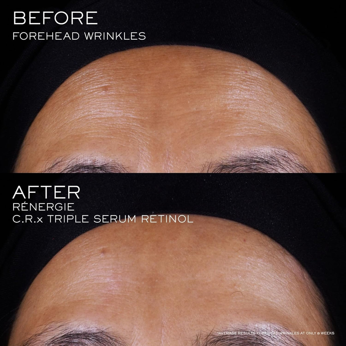 Anti-Aging Face Serum with Retinol & Vitamin C - 50ml / 1.69oz