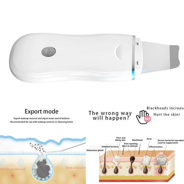 Ultrasonic Pore Cleaner for Blackhead Removal Facial Skin Scrubber
