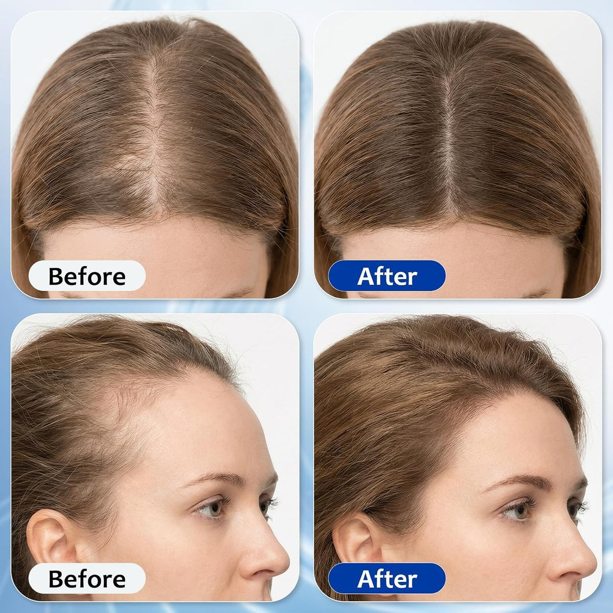Hair Growth Serum Roll On with 3% Rosemary Bataua Oil 2% Pea Extract