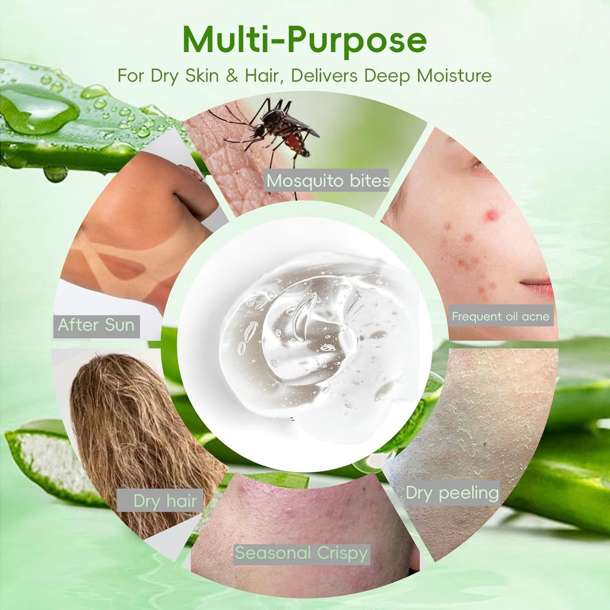 Organic Pure Aloe Vera Gel - Soothing Cooling for Sunburn Relief &