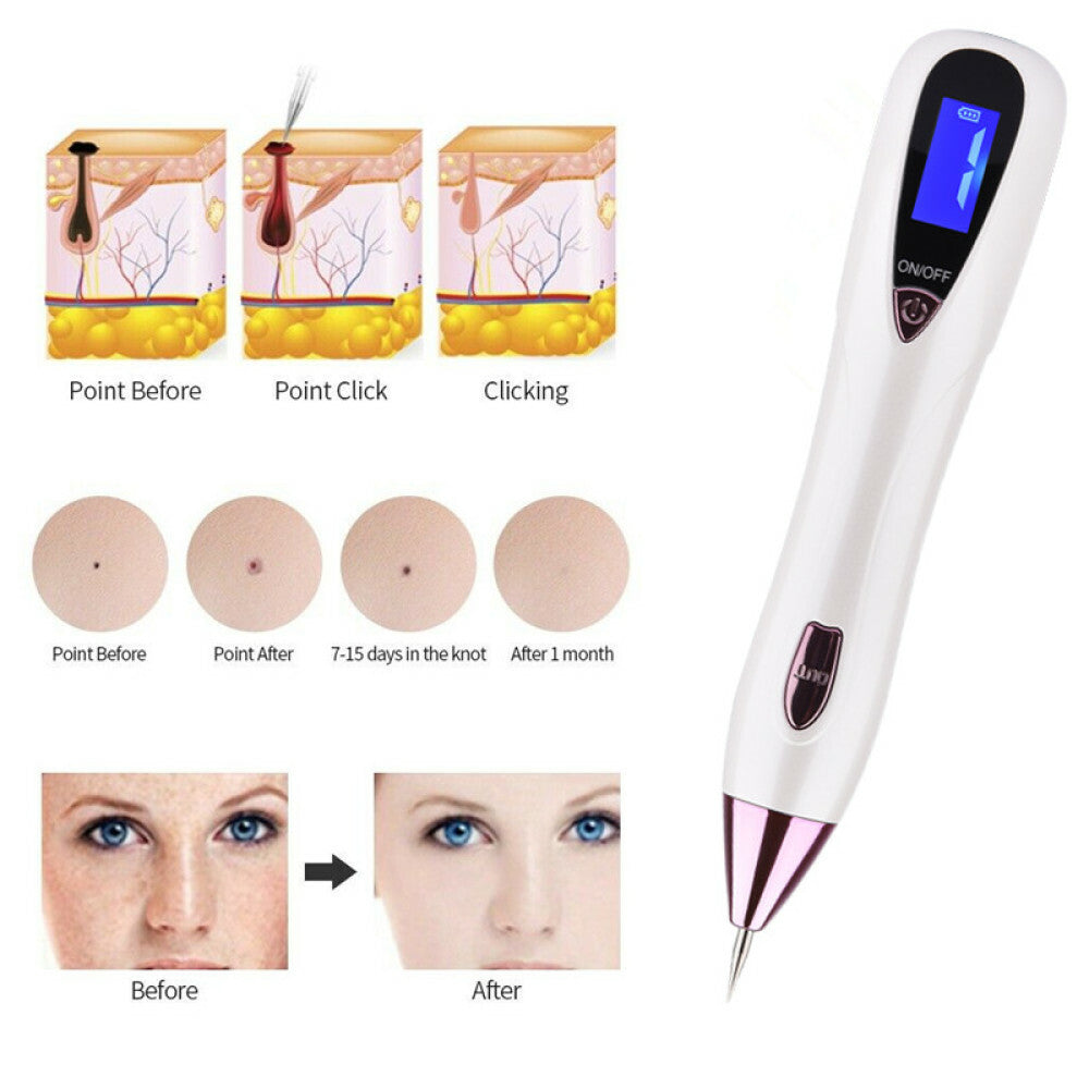 Laser Mole & Wart Removal Pen - LCD Skin Tag Tattoo Spot Fleshy Nevus Remover