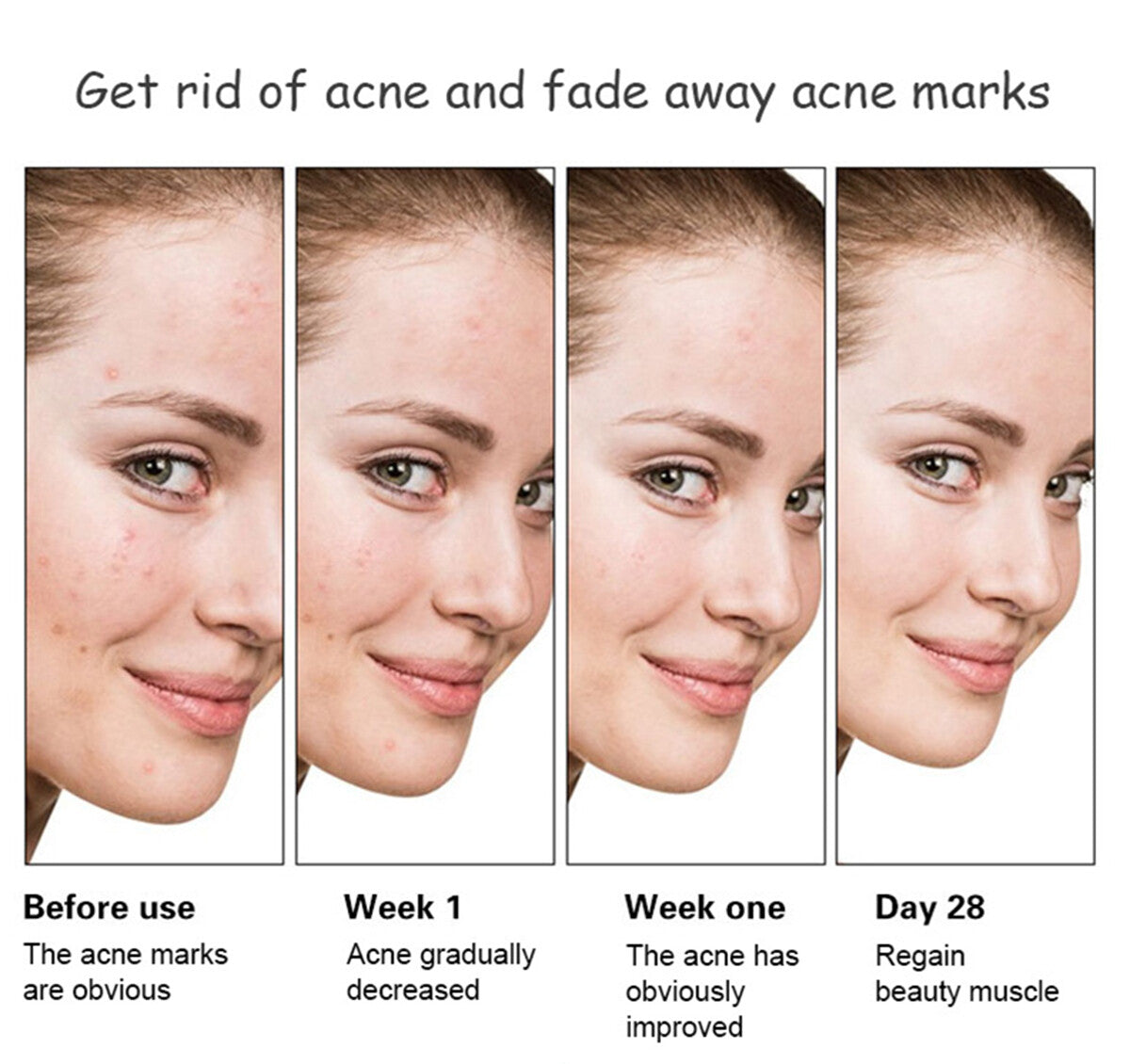 Anti-Acne Face Serum with Aloe Vera & Salicylic Acid for Skin Repair