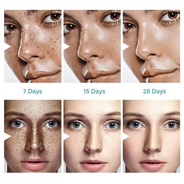 Dark Spot Remover Cream for Face & Body - Anti-Aging & Hyperpigmentation Treatment - 2 Pack