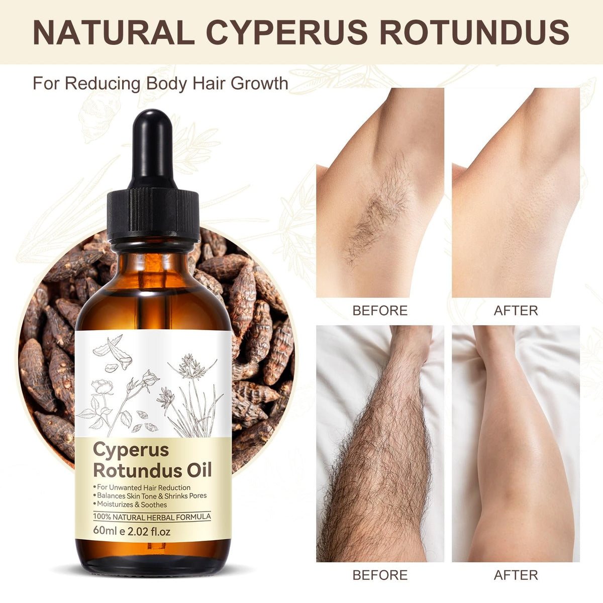 Cyperus Rotundus Oil for Skin & Hair Removal 2 Fl Oz - Natural Moisturizer & Pore Refiner