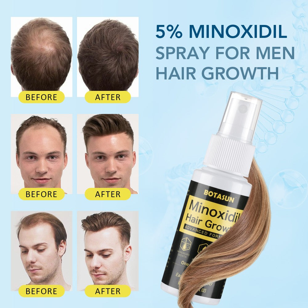 5% Minoxidil Hair Regrowth Spray for Men - 3 Pack