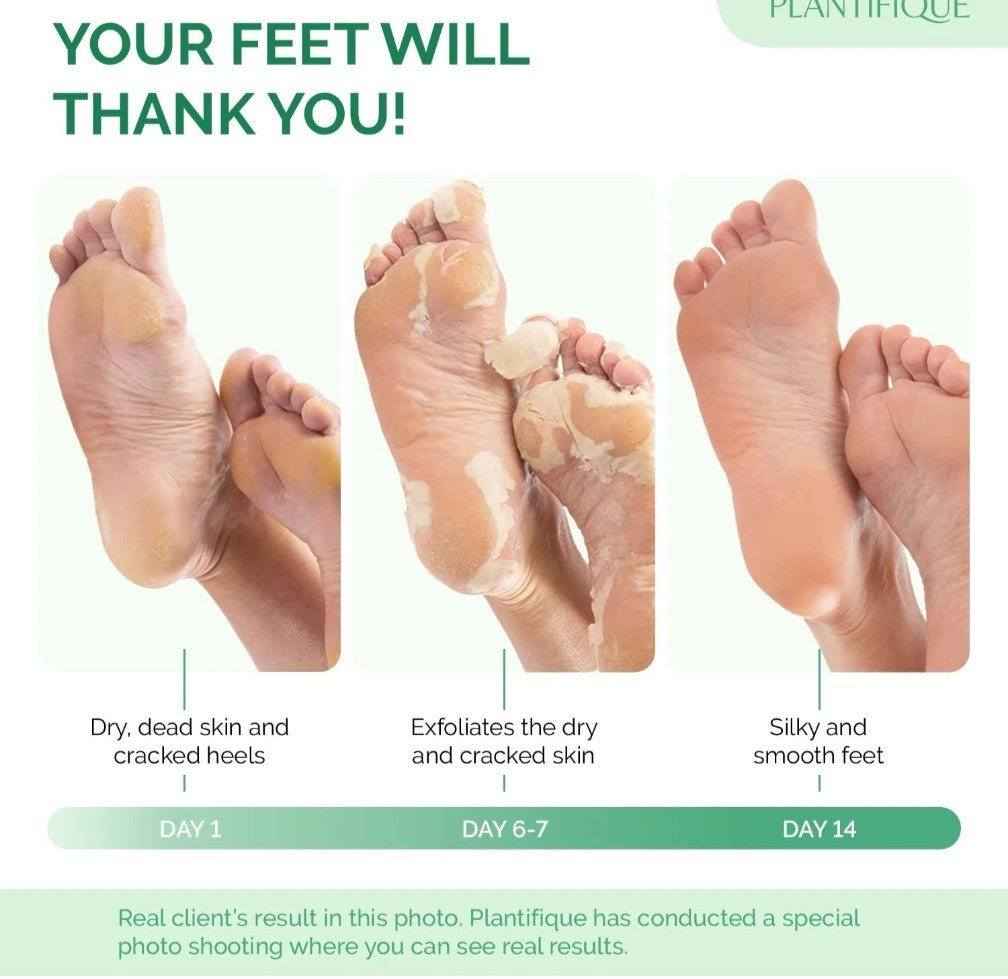 Foot Peeling Mask 2 Pack | Heel Repair & Dead Skin Remover