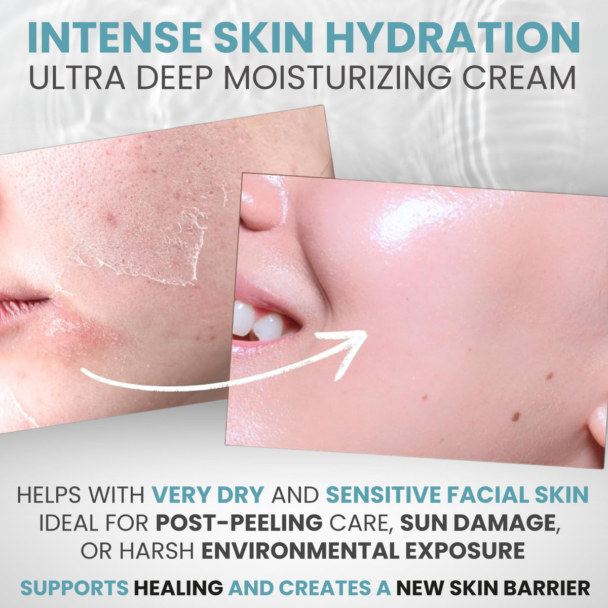 Hyaluronic Acid Face Cream - Anti-Aging Moisturizer, 1.7 oz