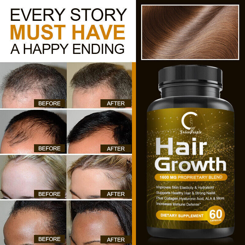 Hair Growth Capsules - 60 Count DHT Blocker Supplement