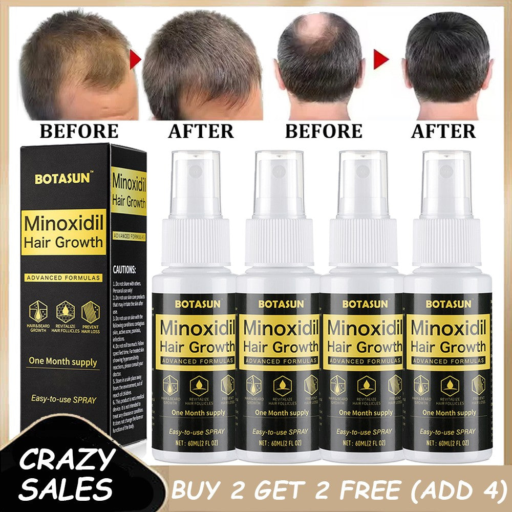 Hair Growth Spray for Men 60ml - 5% Minoxidil Regrowth Treatment