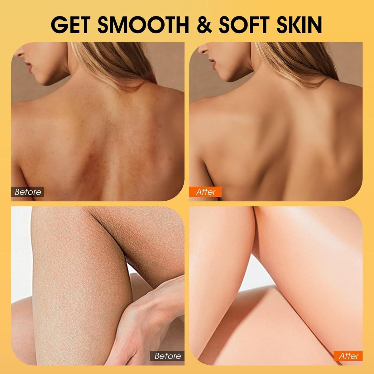 Turmeric Body Scrub Exfoliating Coconut Oil Vitamin C Skin