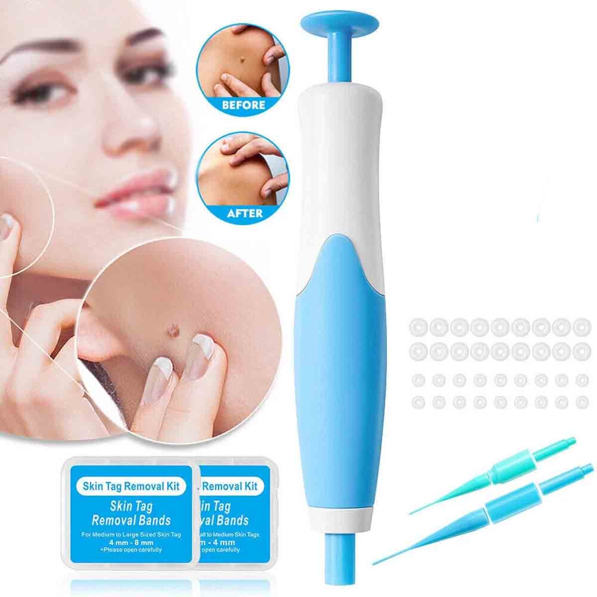 Auto Skin Tag Remover Kit — Painless Wart Removal Pen for Home Use