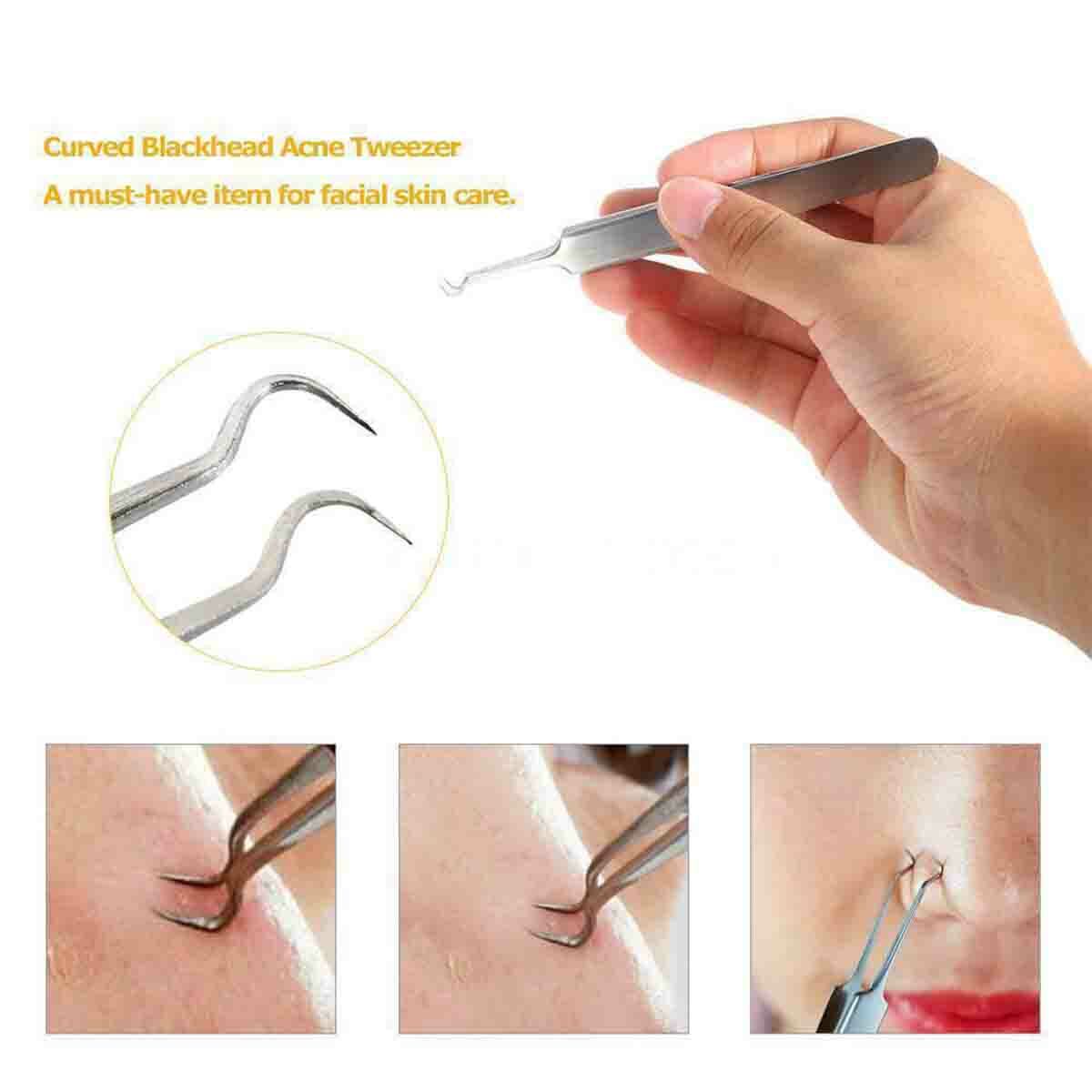 10PC Blackhead & Pimple Extractor Kit - Skin Care Tools for Acne