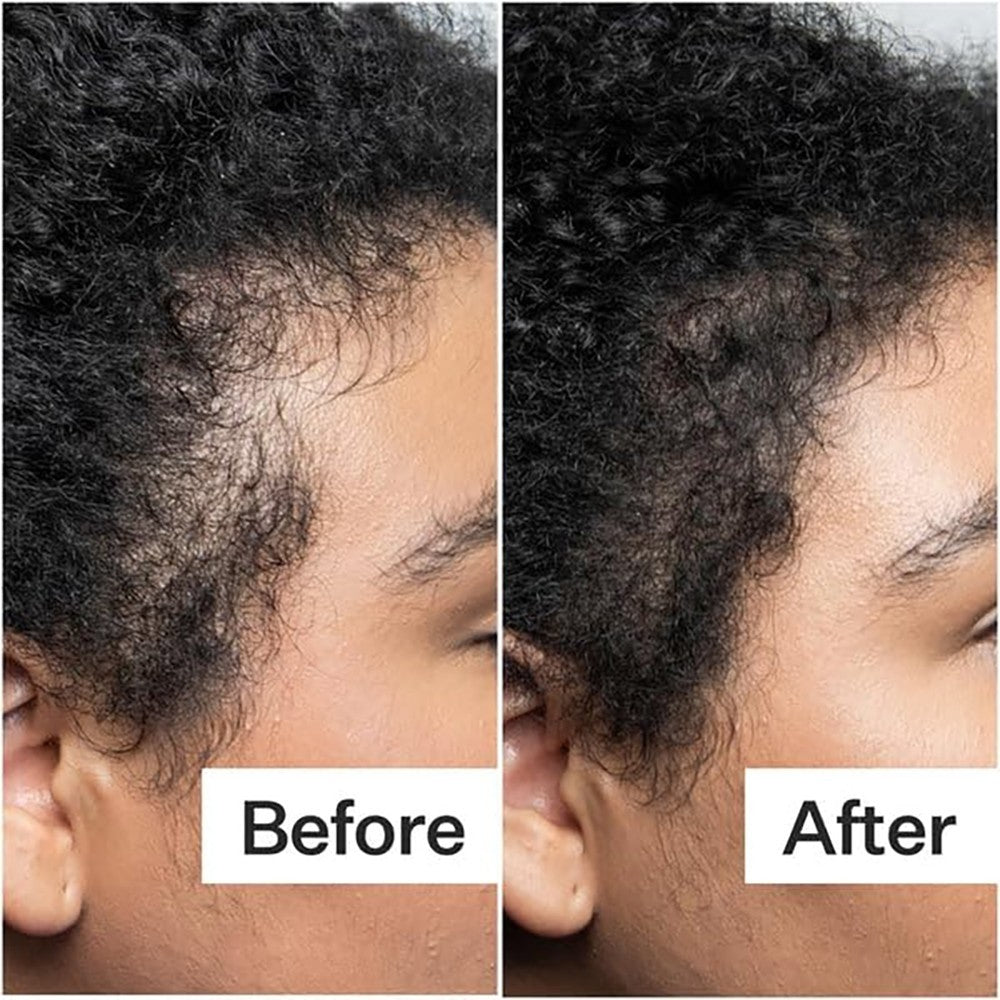 Chebe Hair Growth Set - Shampoo, Conditioner & Serum