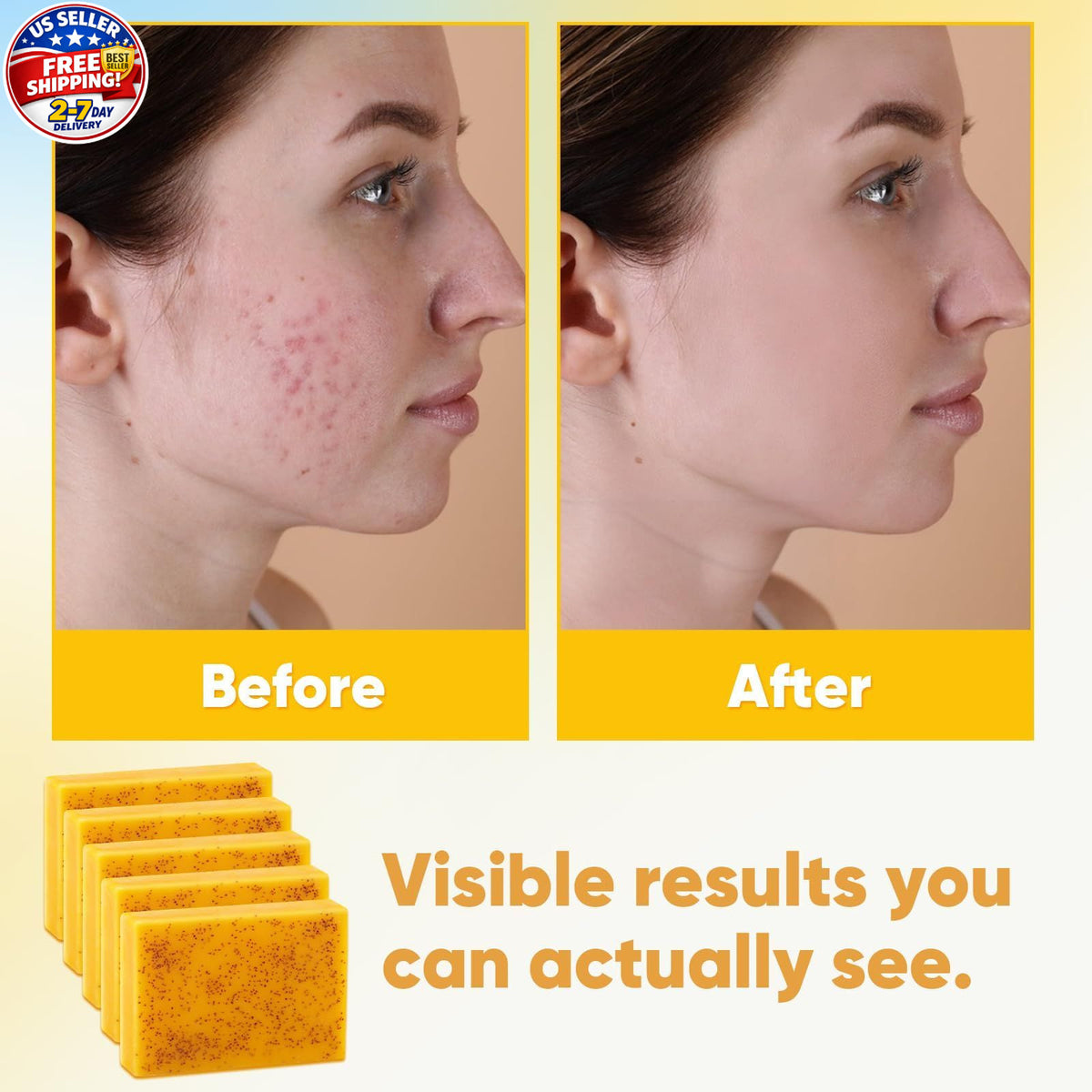 Turmeric Kojic Acid Soap Bar 80g – 5 Pack for Dark Spots Face & Body