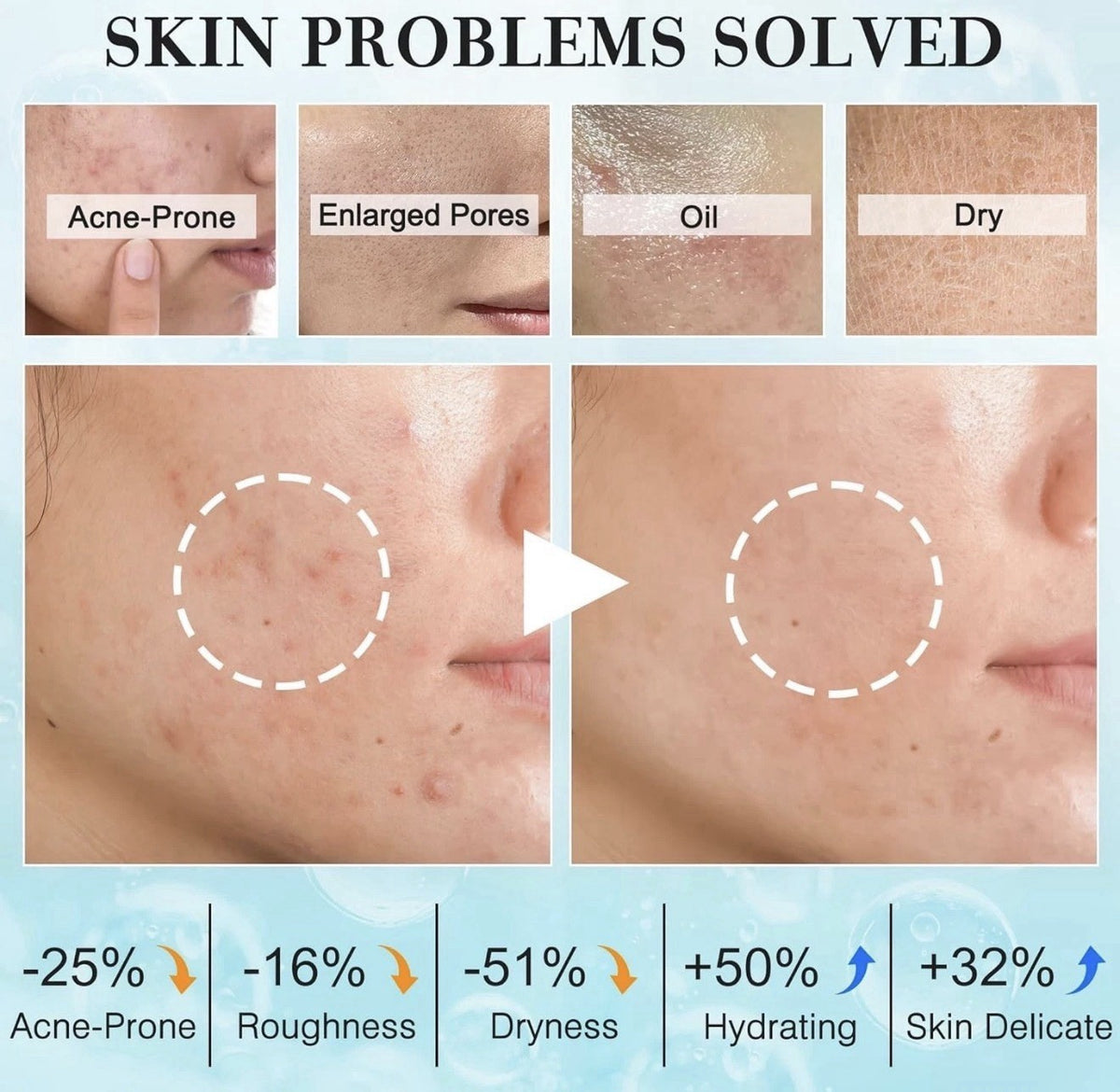 All Skin Types Skin Care Set for Women and Teens - Hydrating & Nourishing