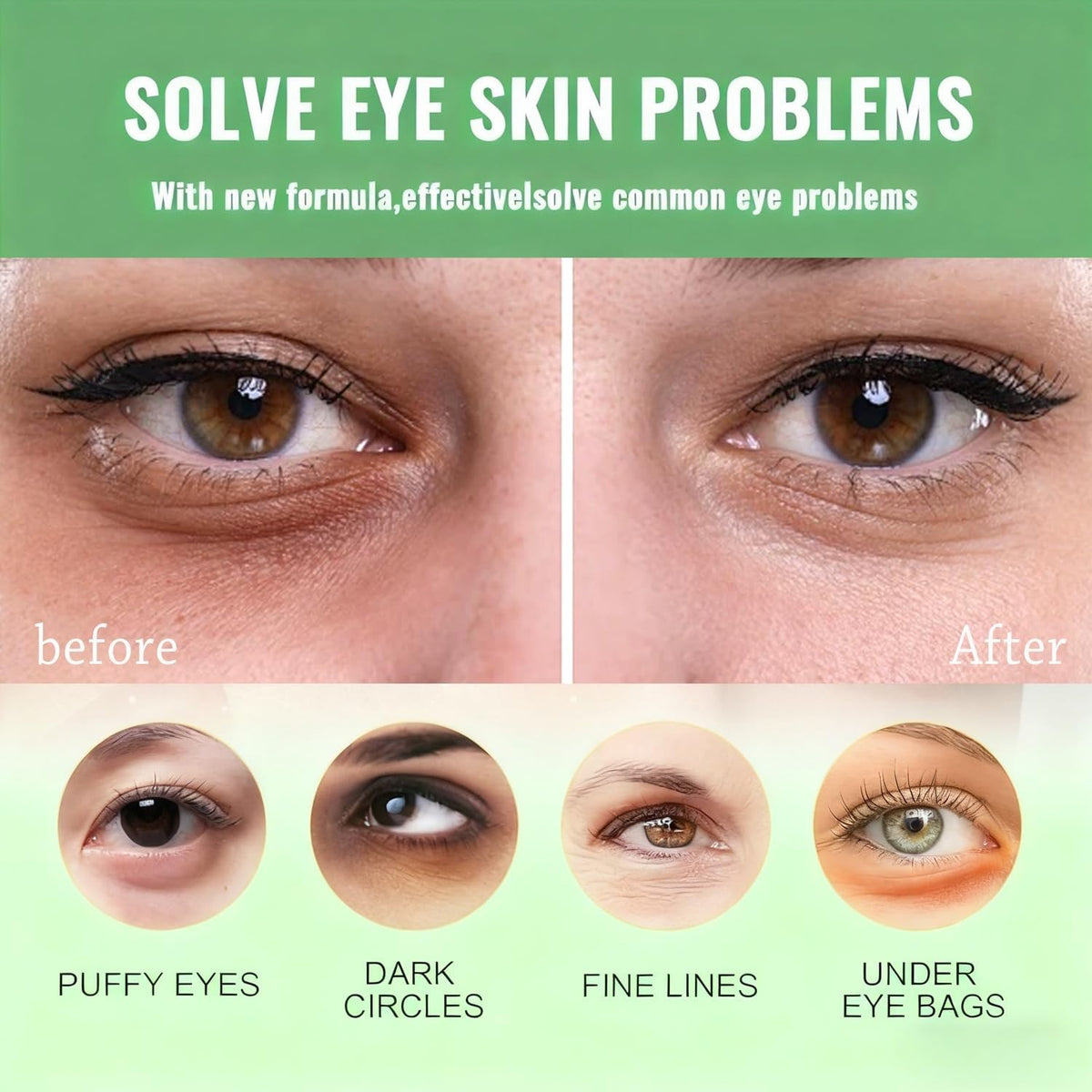 Nourishing Avocado Eye Masks Set for Dark Circles and Puffiness - 60 Pcs