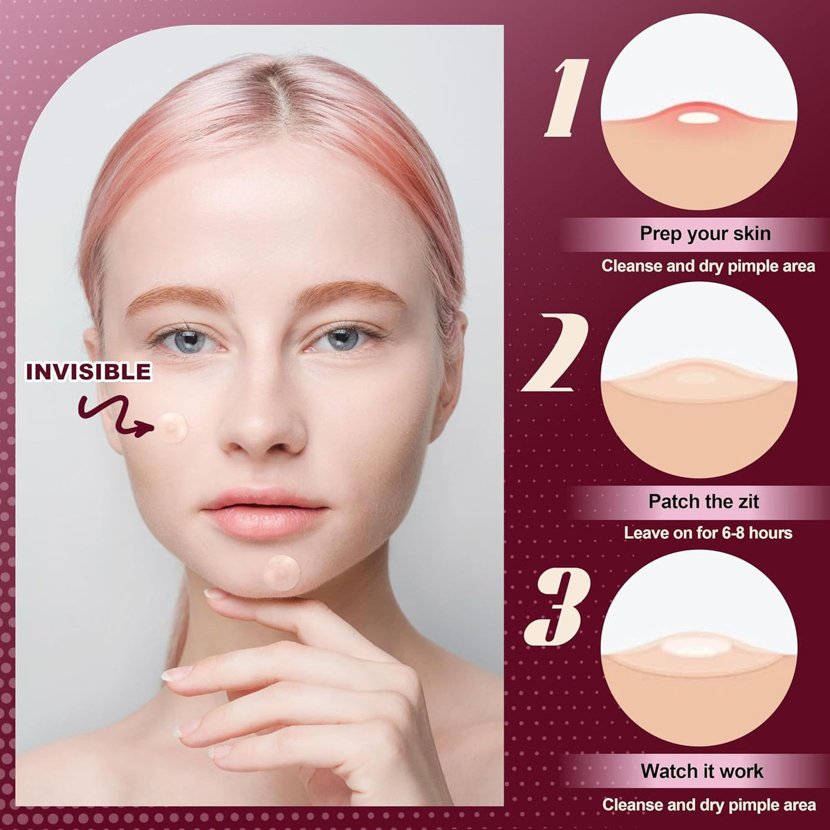 Hydrocolloid Acne Patches for Blemish Covering & Healing - 300 All-Day Skin Discreet