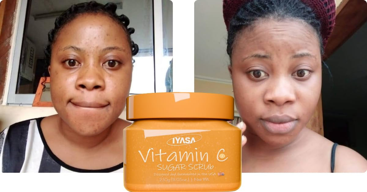 Vitamin C Body Scrub Exfoliating Sugar for Dark Spots Dull Skin 17.9