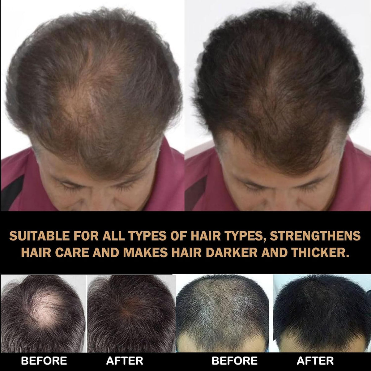 Hair Growth Shampoo for Men - 200ml Root Activator