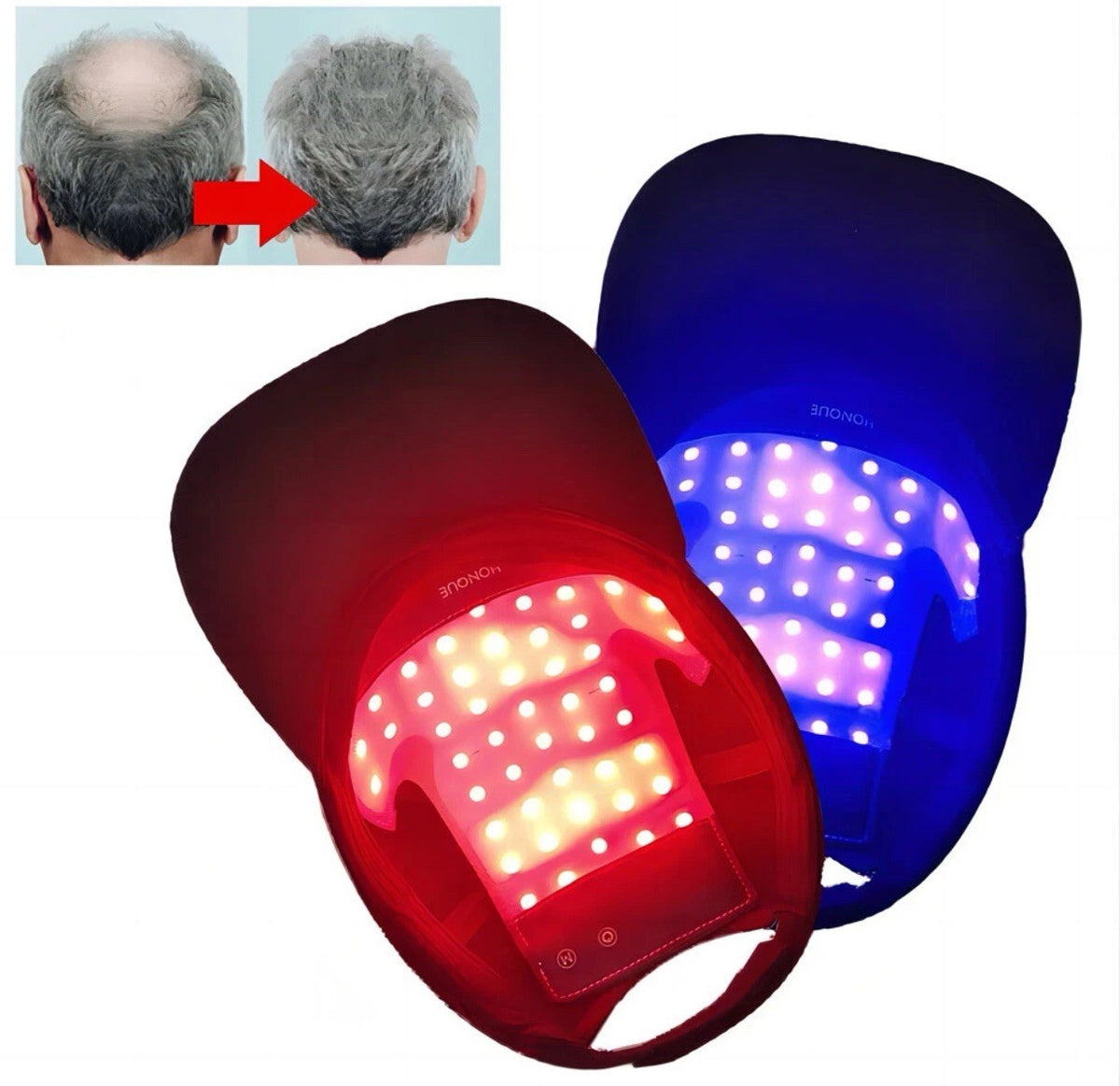 LED Scalp Massage Comb with Red & Blue Light Therapy